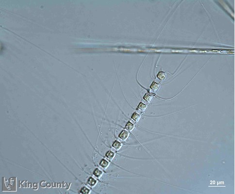 Photo of Chaetoceros crucifer